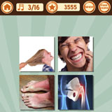  Pain 